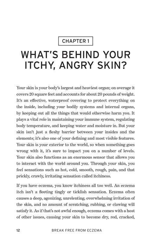 Break Free from Eczema by Rachel Zohn
